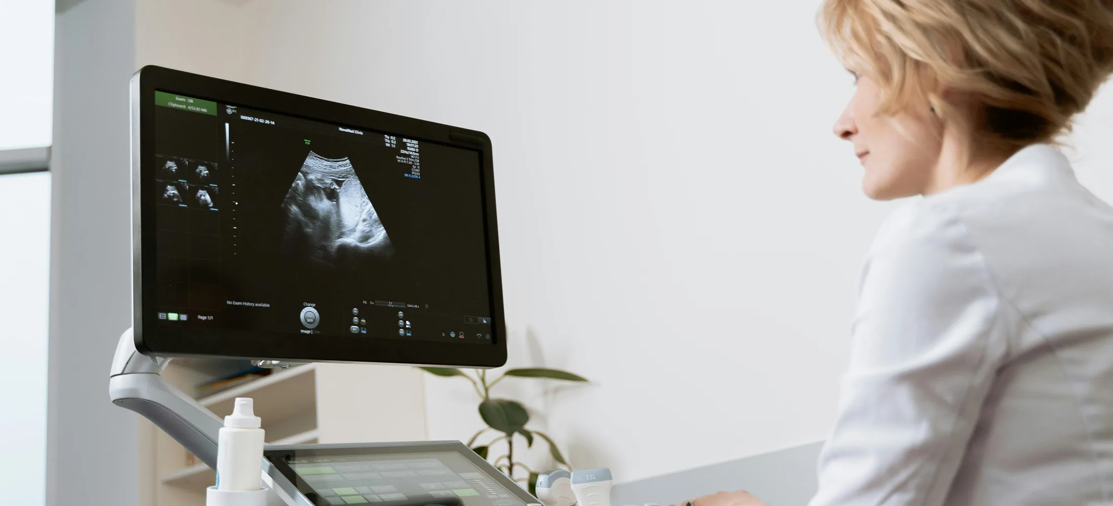 Ultrasound rental systems staged for clinical imaging use
