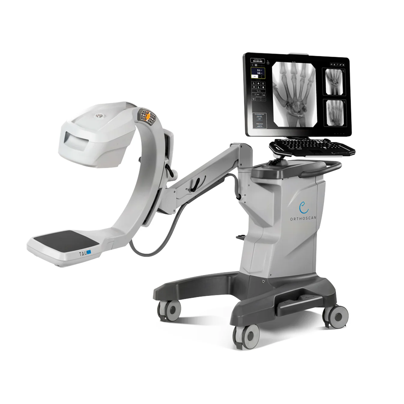 Orthoscan Tau 1512 Mini C-Arm Rental