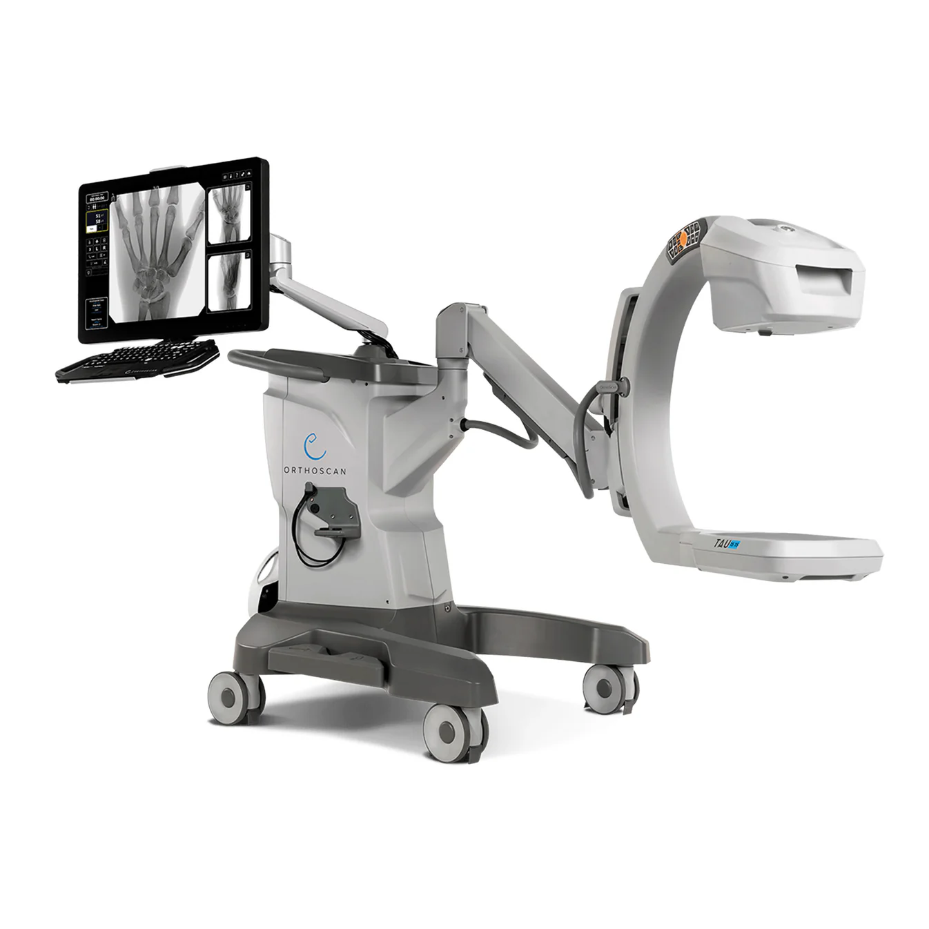 Orthoscan Tau 1515 Mini C-Arm Rental