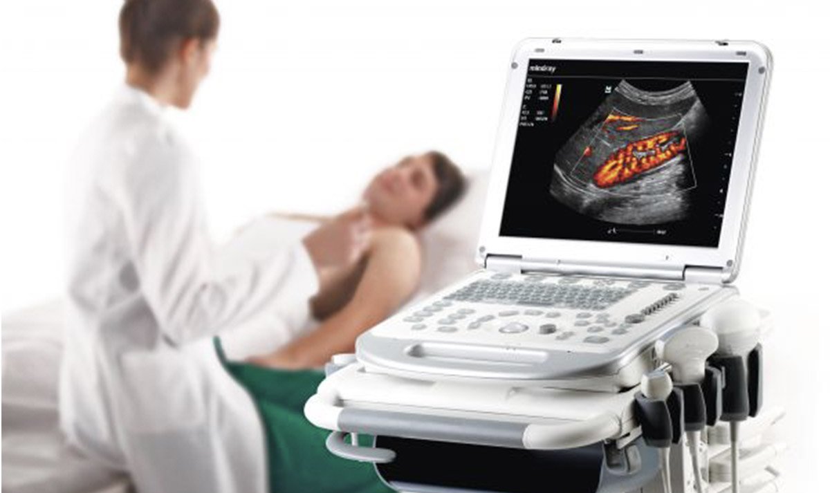 rent ultrasound machines