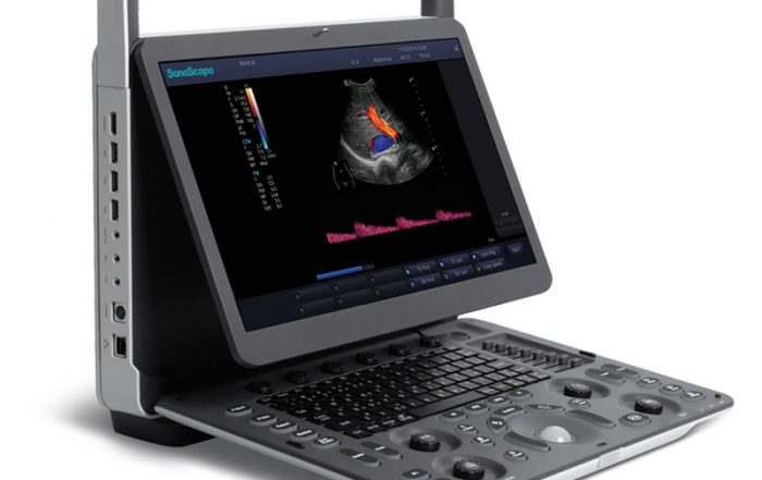 Sonoscape E2 Ultrasound Rental