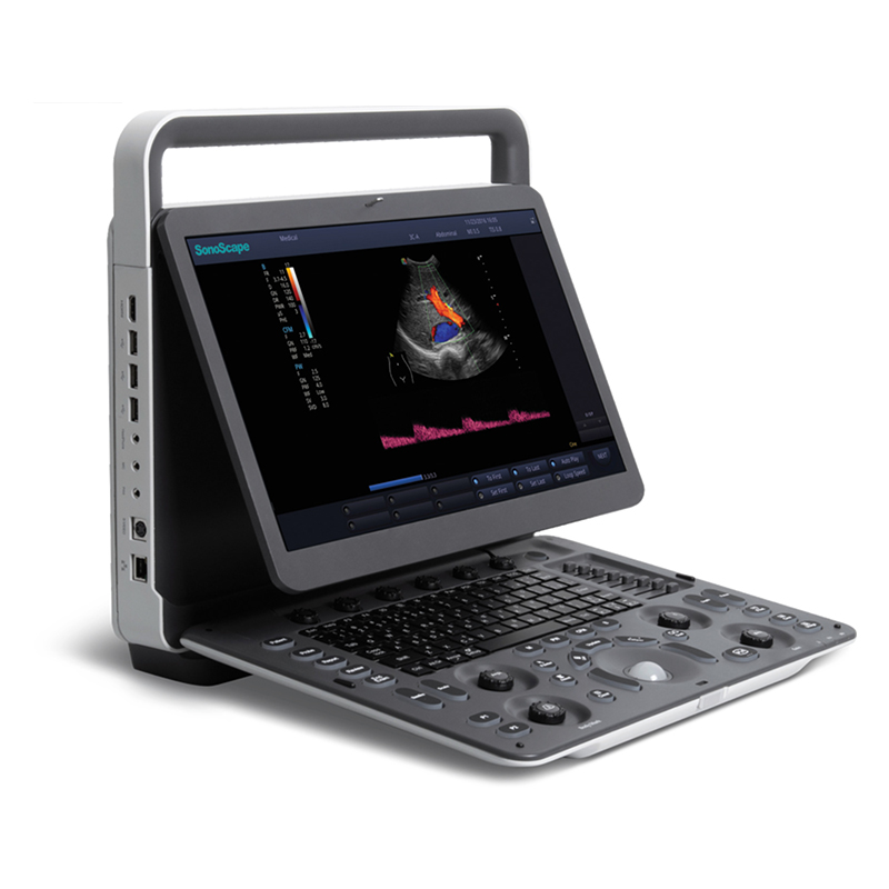 Sonoscape E2 Ultrasound Rental