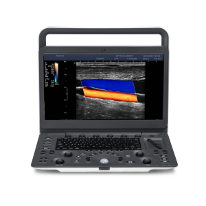 Sonoscape E2 Ultrasound Rental